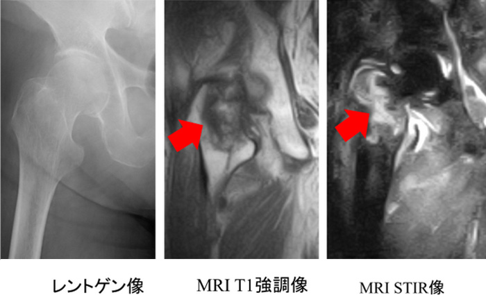 レントゲン画像