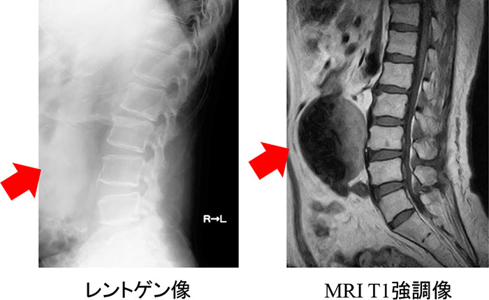 レントゲン画像