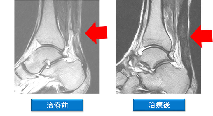 レントゲン画像